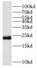 PRDX1 antibody|PRDX1抗体 FNab067