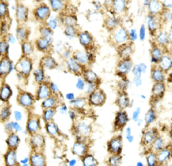 TAU antibody|TAU抗体 FNab08505