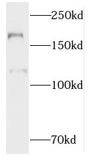 MTUS1 antibody|MTUS1抗体 FNab054