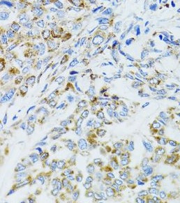 EGFR antibody|EGFR抗体 FNab02668