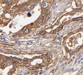 PNLIP antibody|PNLIP抗体