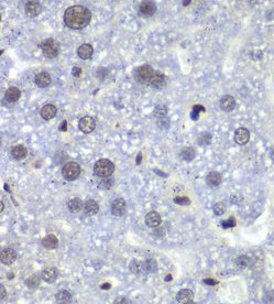 RBBP5 antibody|RBBP5抗体