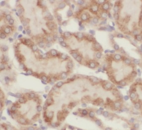 ASPH antibody|ASPH抗体