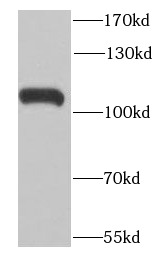 RNASEL antibody|RNASEL抗体