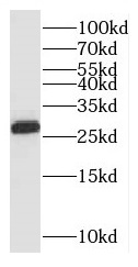 PSMA3 antibody|PSMA3抗体
