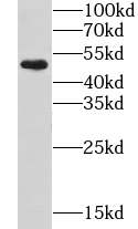 GTF2E1 antibody|GTF2E1抗体