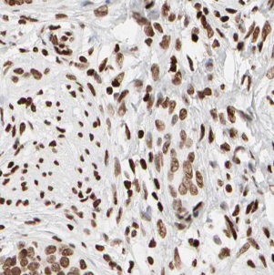 USP1 antibody|USP1抗体 FNab09302