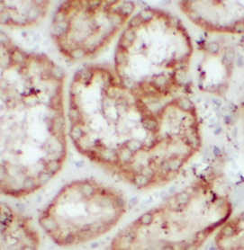 SLC4A4 antibody|SLC4A4抗体 FNab1