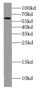 GPS1 antibody|GPS1抗体