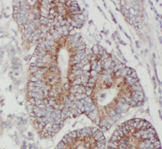 JMY antibody|JMY抗体