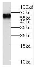 NOP56 antibody|NOP56抗体