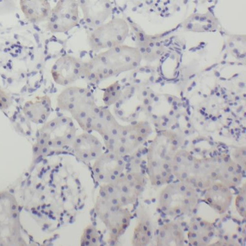 RIMBP2 antibody|RIMBP2抗体