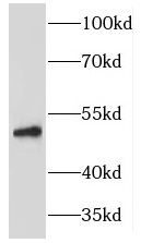 HARS1 antibody|HARS1抗体