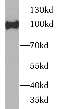 HCN1 antibody|HCN1抗体 FNab03787