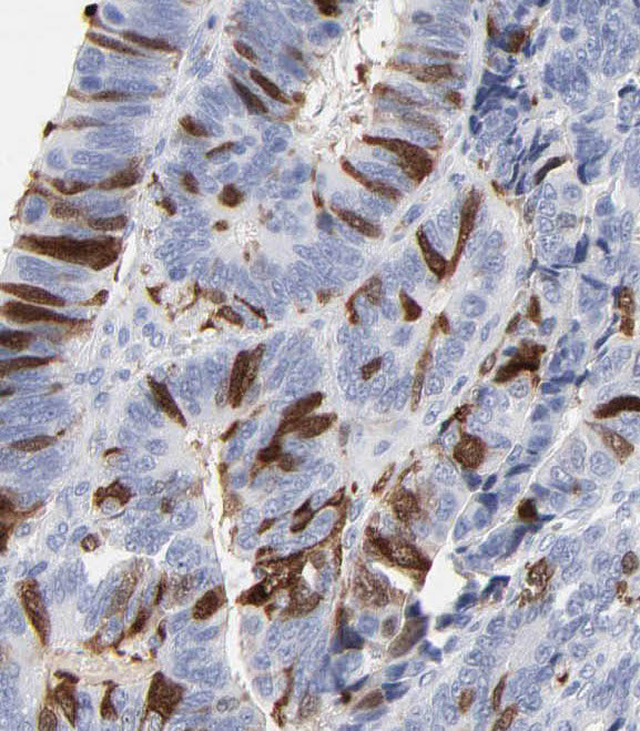 PRKCSH antibody|PRKCSH抗体