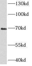 CHGA antibody|CHGA抗体 FNab01687