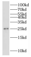 RPP25 antibody|RPP25抗体