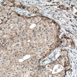 FGFR4 antibody|FGFR4抗体