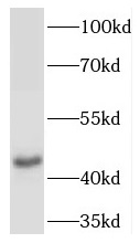 TACR2 antibody|TACR2抗体
