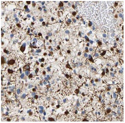 RAB5A antibody|RAB5A抗体