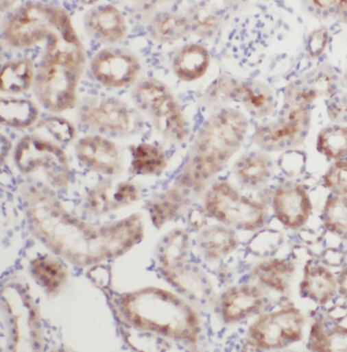 TACO1 antibody|TACO1抗体