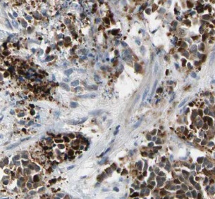 DDIT3 antibody|DDIT3抗体 FNab100