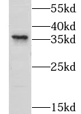 LYSMD3 antibody|LYSMD3抗体