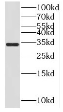 HSD17B11 antibody|HSD17B11抗体 F