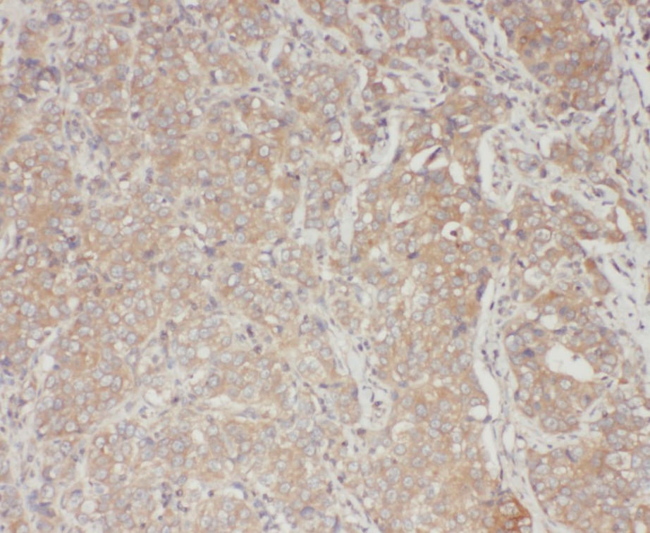 STAT3 antibody|STAT3抗体 FNab082