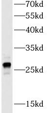 GSTM1 antibody|GSTM1抗体 FNab099