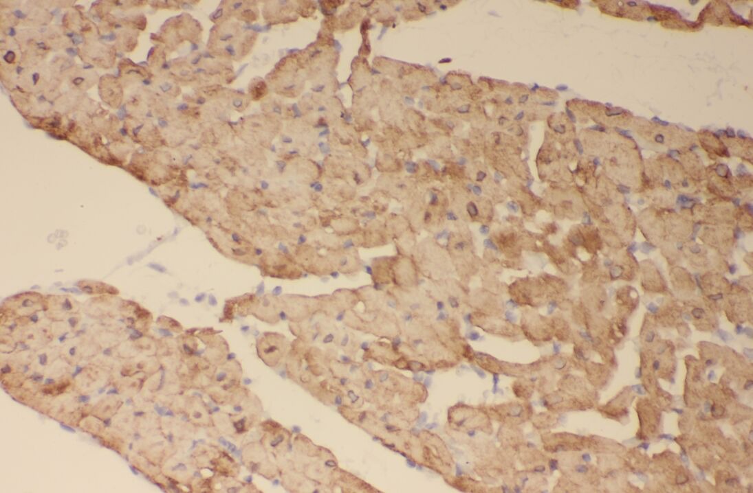 SOCS3 antibody|SOCS3抗体