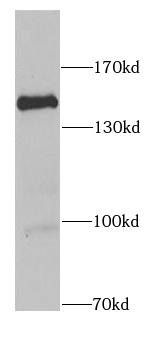 RASGRF1 antibody|RASGRF1抗体