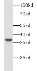 CXXC5 antibody|CXXC5抗体