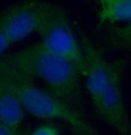 MIF antibody|MIF抗体