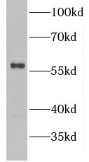 GDAP2 antibody|GDAP2抗体