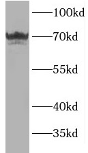 USH1C antibody|USH1C抗体 FNab037
