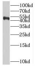 BPIFB2 antibody|BPIFB2抗体