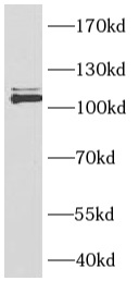 NCOR1 antibody|NCOR1抗体 FNab100