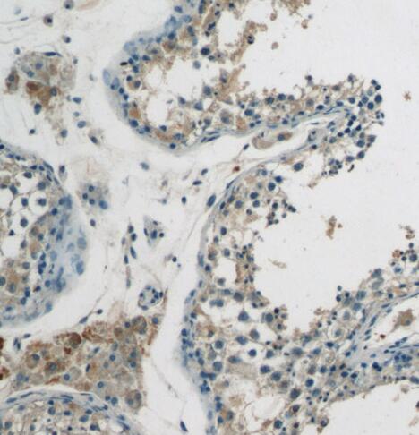 SPRED2 antibody|SPRED2抗体