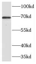 TDP1 antibody|TDP1抗体