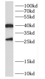 CENPN antibody|CENPN抗体