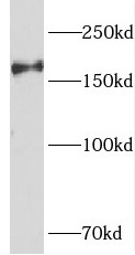 PIK3C2B antibody|PIK3C2B抗体