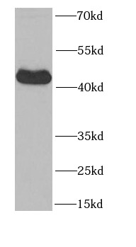 PAWR antibody|PAWR抗体