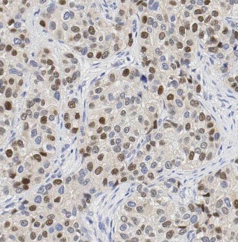 DUSP4 antibody|DUSP4抗体