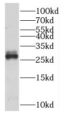 MLF2 antibody|MLF2抗体