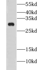 CLEC12B antibody|CLEC12B抗体