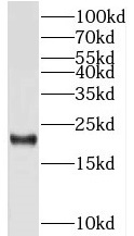 TMED10 antibody|TMED10抗体