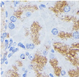 PLA2G1B antibody|PLA2G1B抗体