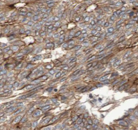 KLK11 antibody|KLK11抗体