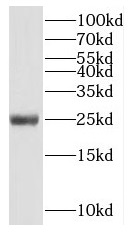 NUDT3 antibody|NUDT3抗体